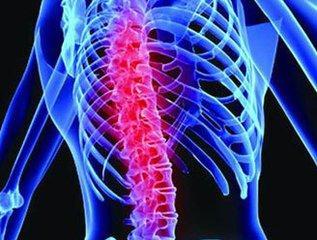 脊髓损伤临床可分三类 必须掌握现场急救措施
