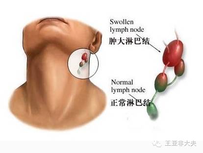 這些淋巴組織包括胸腺,骨髓,脾和淋巴結.